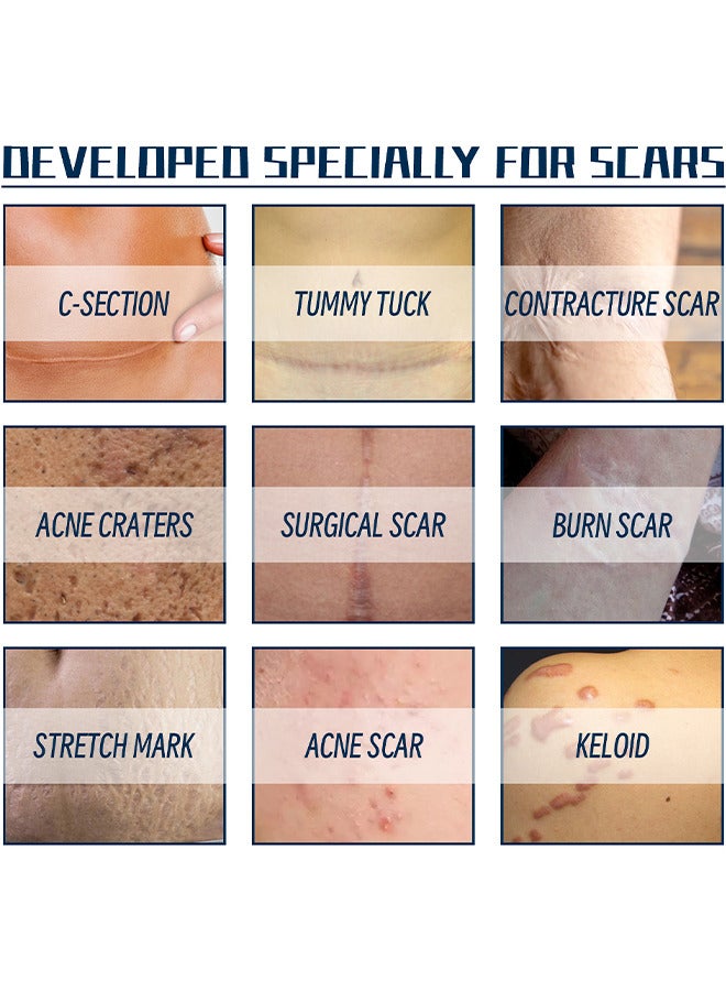 West&Month Silicone Scar Removal Gel, Hight Quality Scar Removal Gel, Acne Scar Treatment, Deep Acne Scar Removal, Burns Keloids Hypertrophic, Repair Damaged Skin, Removing Acne Marks Scar Repair Cream ﻿ - Image 4