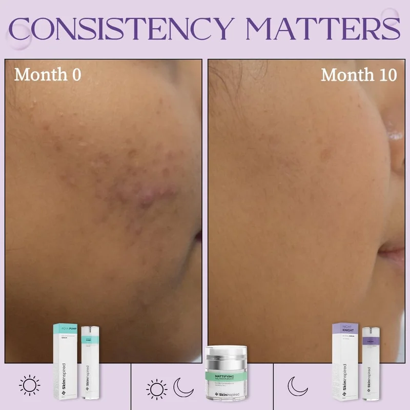 Skininspired  SkinInspired Retinol Face Serum (2% vitAlease) | Retinol Serum For Face Anti Aging | Promotes Cell Turnover for Youthful, Smooth Skin | Suitable For Men & Women | All Skin Types | 30ml for Women | Best Price UAE