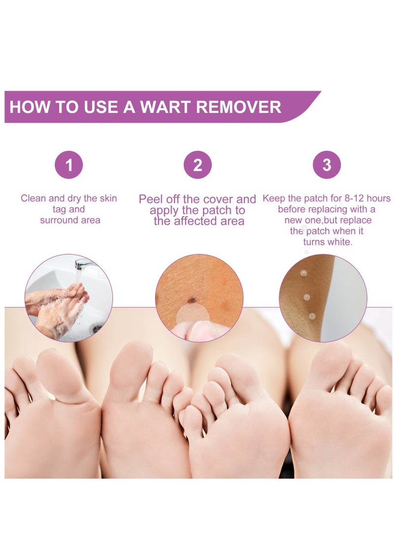 Elaimei - 144 Pieces Skin Tag Remover Patches Acne Tag Mole Remover Patch Natural Safe Effective Skin Tag Removal Patches to Remove Acne Dark Spot Wart for Face and Body - Image 1
