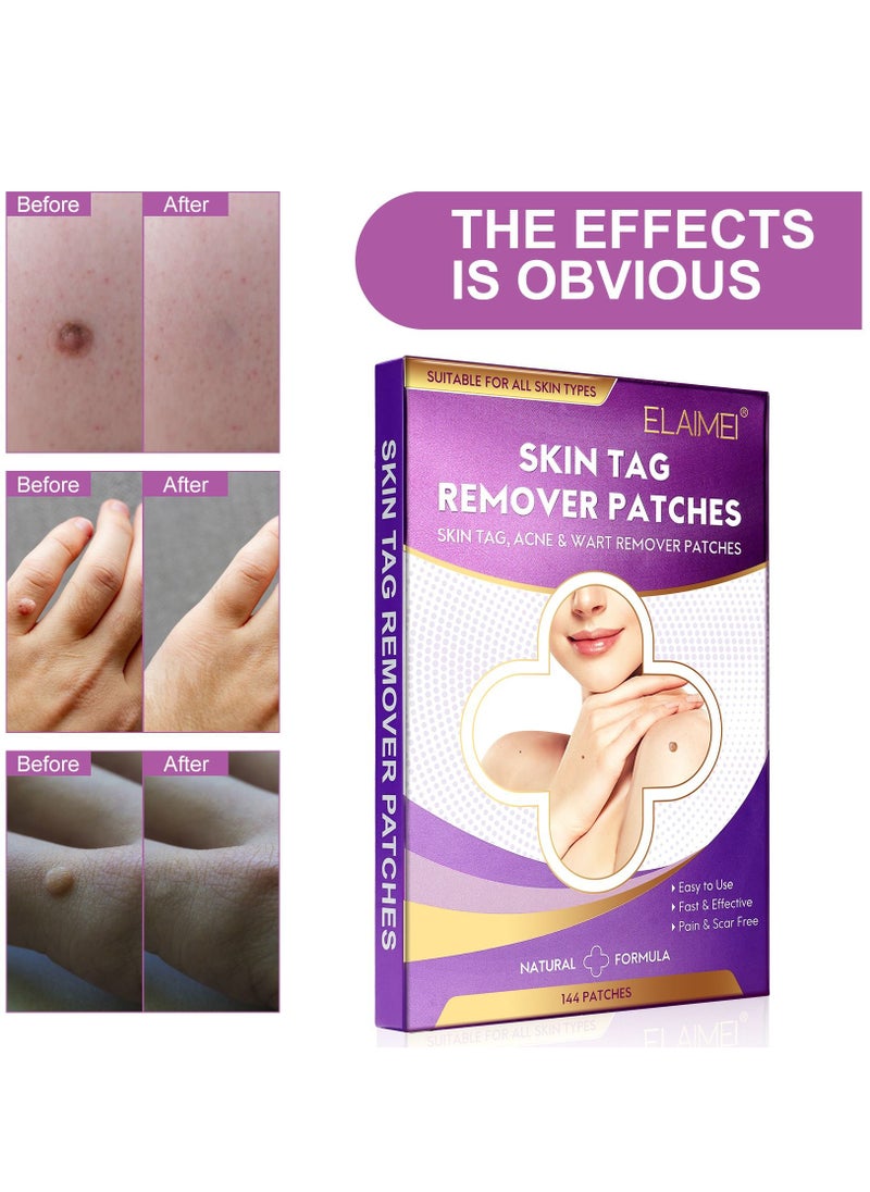 Elaimei - 144 Pieces Skin Tag Remover Patches Acne Tag Mole Remover Patch Natural Safe Effective Skin Tag Removal Patches to Remove Acne Dark Spot Wart for Face and Body - Image 1