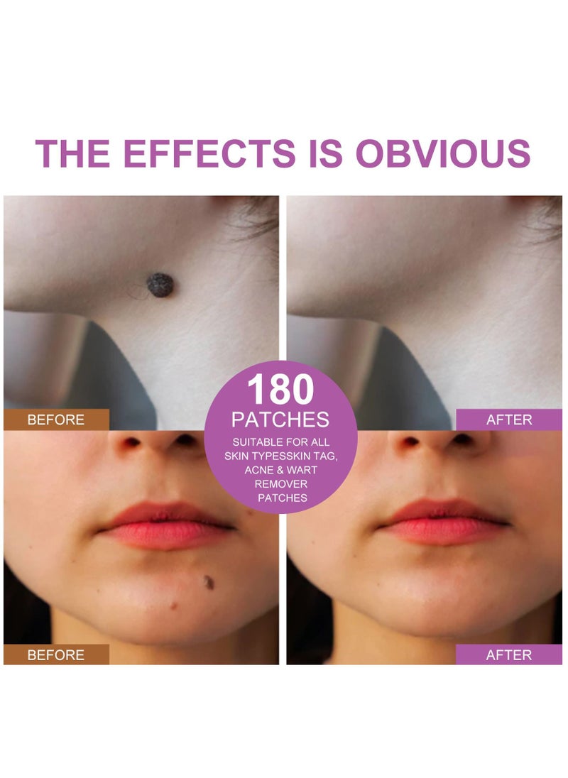Elaimei - 144 Pieces Skin Tag Remover Patches Acne Tag Mole Remover Patch Natural Safe Effective Skin Tag Removal Patches to Remove Acne Dark Spot Wart for Face and Body - Image 1