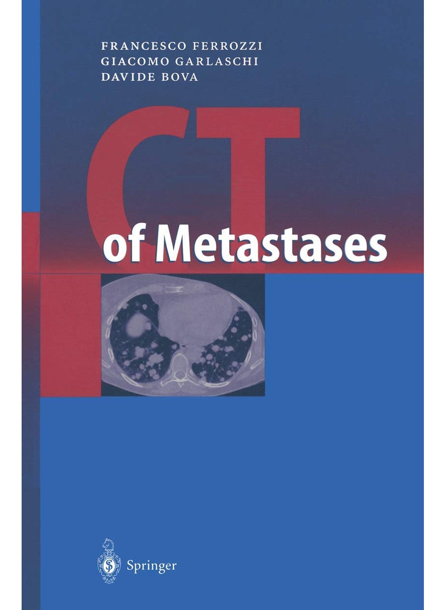 CT of Metastases 