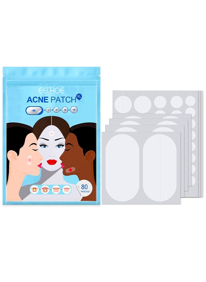 EELHOE Acne Patch -Big Acne Patches, XL Hydrocolloid Bandages for Full Face, Forehead, Chin, Nose, Body, Back, Neck & Chest, Oval, Moon, Square hydrocolloid Patch ( 80 Patches) - Image 1