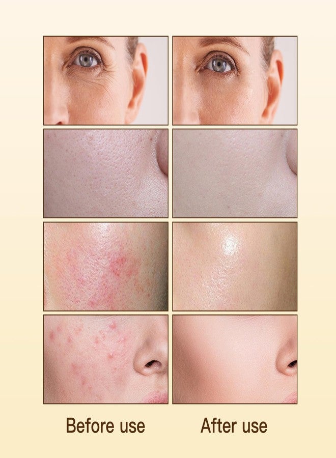 Warmtree Madagascar Centella, Facial Serum for face, Natural Extraction of Bakuchiol, Centella Asiatica Extract for Soothing Sensitive& Acne-Prone Skin, for Scars, Moisturizing& Firming- 45ml - Image 4