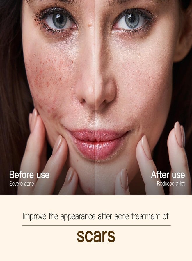 Warmtree Madagascar Centella, Facial Serum for face, Natural Extraction of Bakuchiol, Centella Asiatica Extract for Soothing Sensitive& Acne-Prone Skin, for Scars, Moisturizing& Firming- 45ml - Image 3