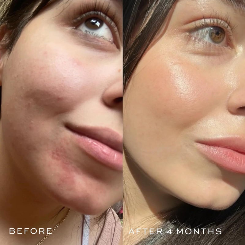 DIME Beauty Blue Facial Oil, 1 oz / 30 mL - Blemish Spot Treatment with Blue Tansy, Black Cumin Seed, Rosehip, and Grapeseed Oils - Image 3