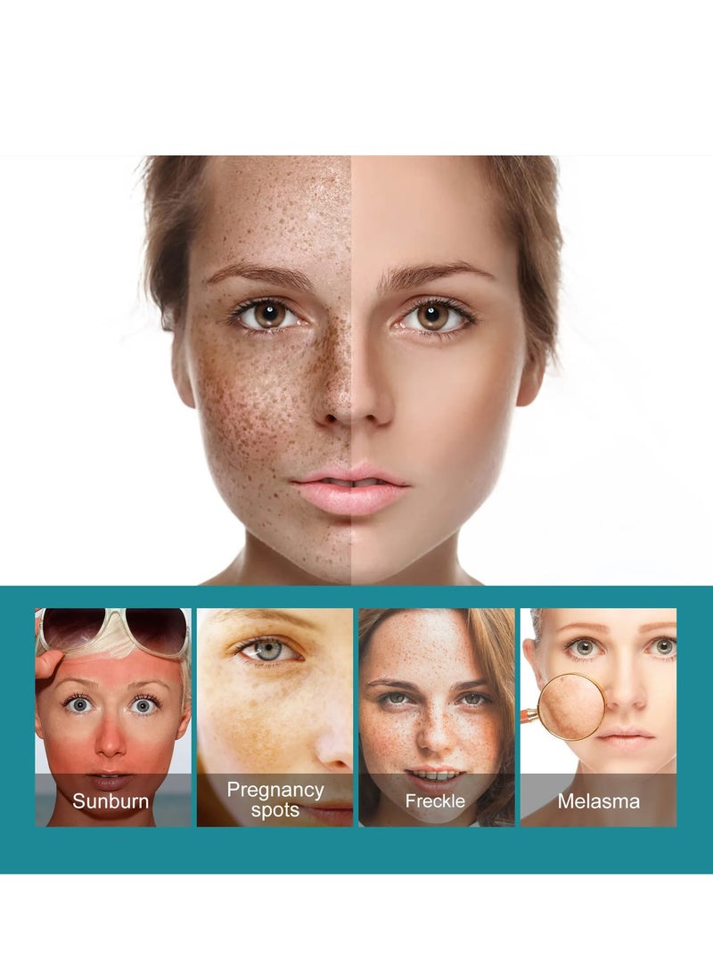 EELHOE - Black Spot And Anti-Aging Serum, Spot Lightening Serum For Face And Body, Reduces Hyperpigmentation, Age Spots, Sun Spot, Improve Skin Tone - Image 1