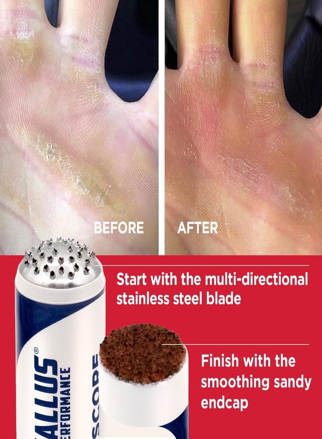 Callus Performance Callus Score - Precision Hand Callus Remover for Athletes | Prevents Ripping | Callus Management for Weightlifters, Cross Training, Gymnastics and More | Callus Performance - we just do calluses - Image 2