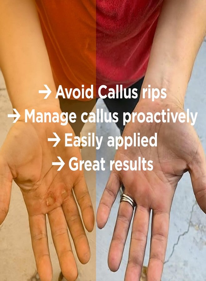 Callus Performance Callus Score - Precision Hand Callus Remover for Athletes | Prevents Ripping | Callus Management for Weightlifters, Cross Training, Gymnastics and More | Callus Performance - we just do calluses - Image 5