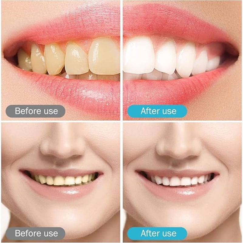 TWINZEN Whitening Stripes for Teeth, Teeth Care, Teeth Whitening Strip with 14 Pieces and 7 Pairs, 30 Minute Teeth Whitening Strips, 7d Mint Dental Patch Teeth Stain Remover at Home - Image 3