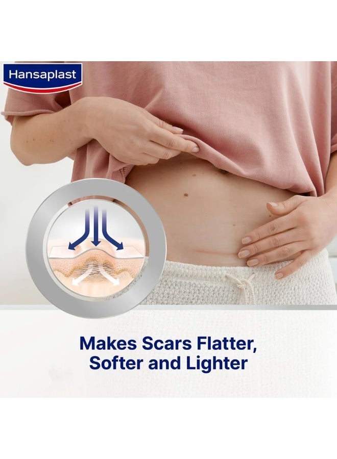 هانزابلاست لصقات هانزابلاست (Hansaplast) الذاتية اللاصقة لتقليل الندبات - 21 قطعة - Image 2