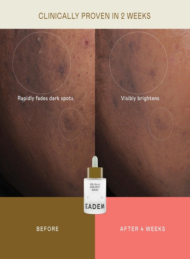 سيروم إيديم ميلك مارفل لعلاج البقع الداكنة، سيروم للوجه غني بفيتامين سي والنياسيناميد، مزيل للبقع الداكنة للوجه والجسم، مصحح طبيعي للبقع الداكنة للعناية بالبشرة، 1 أونصة - Image 4