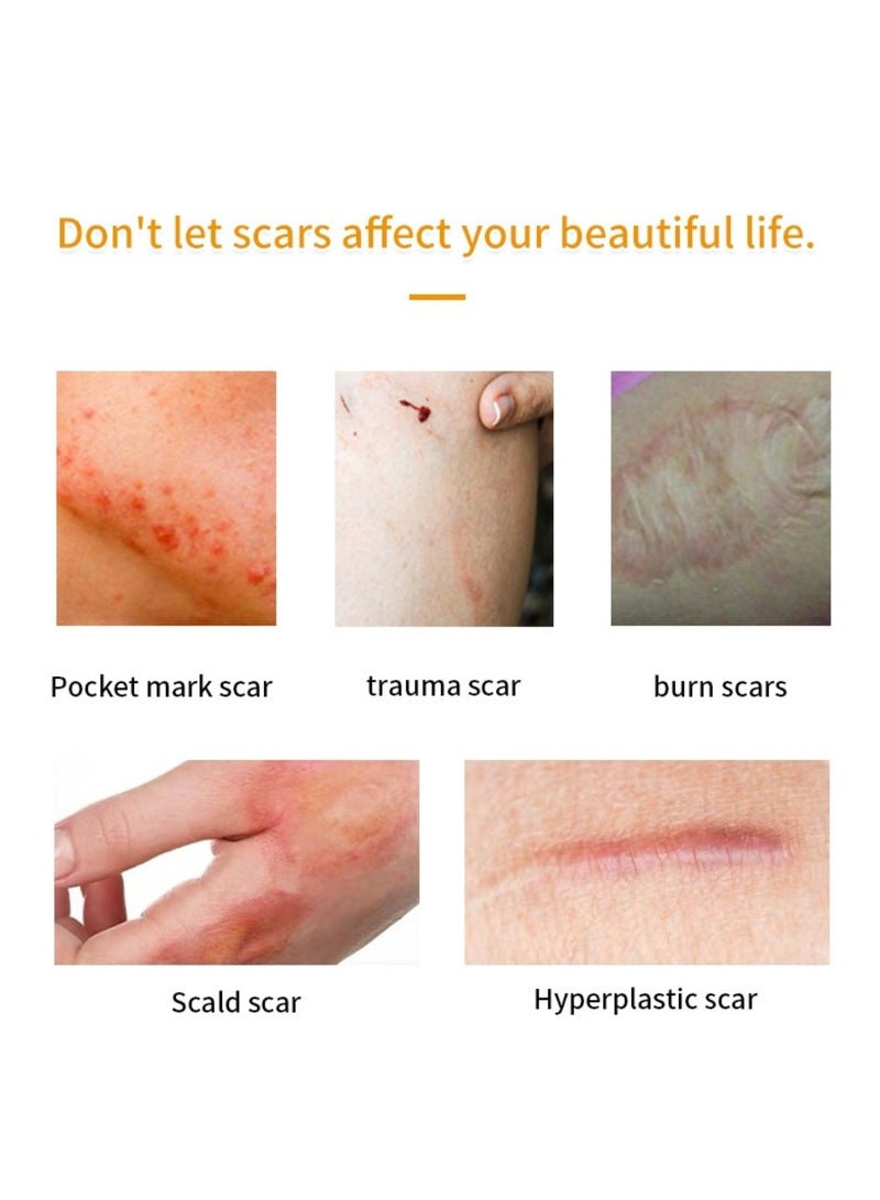 PUVIDA Scar Treatment Cream Reduce Scars and Marks for Dead Skin Elimination Minimize Pores Damaged Skin Acne Scars Pregnancy Lines Hydrates and Skin Repair Scar Removal Cream 20g - Image 4