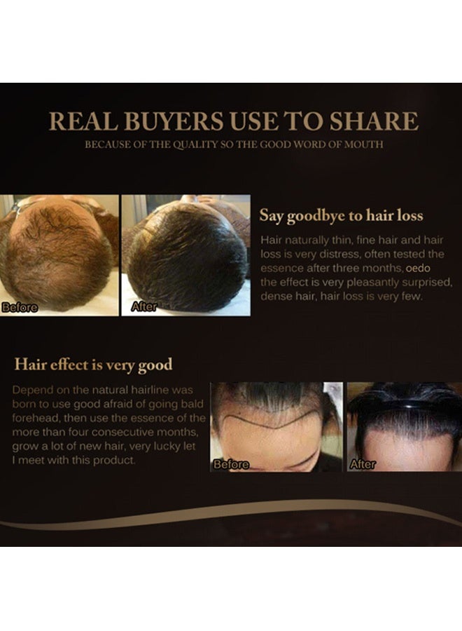 OEDO Moroccan hair growth serum - Image 5