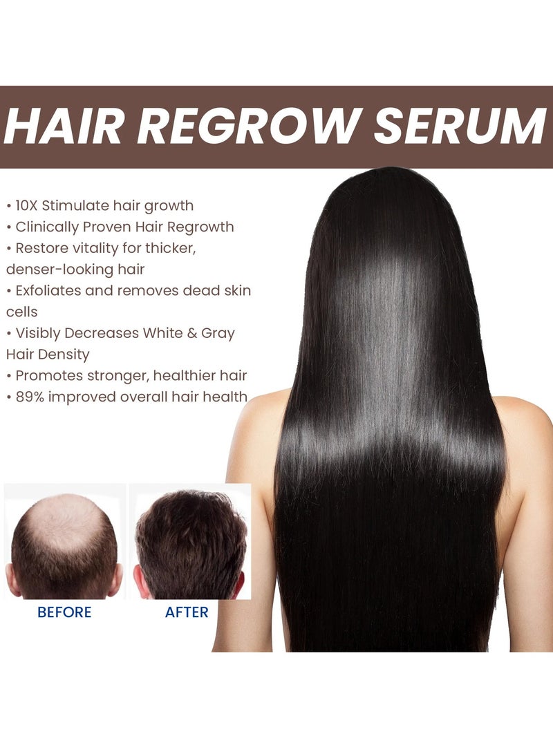EELHOE سيروم الشعر للنمو السريع، زيت علاج تساقط الشعر، زيت مغذي لجذور الشعر القوية، زيت أساسي فعال لنمو الشعر التالف والمجعد - Image 4
