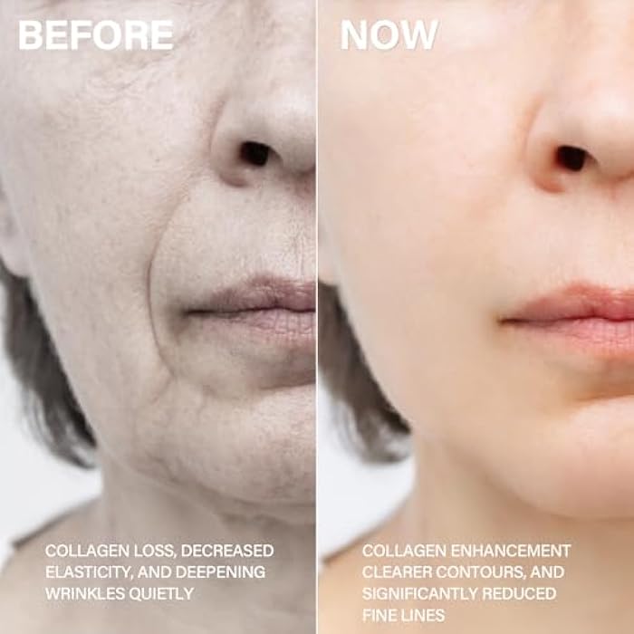 HANASCAR Salmon DNA Serum – Premium Korean Skin Care Skincare Booster, Ultra-Extracted Tech for Damaged-Skin Recovery & Age Defense, 1.23 fl.oz - Image 3