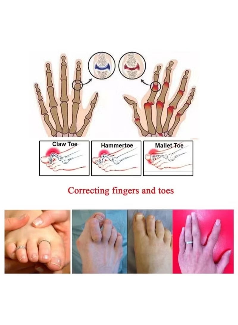 Generic 8-Piece Toe Splint Wraps Non Slip Hammer Straightener For Broken Crooked Overlapped And Toes-Women Men  - Image 3