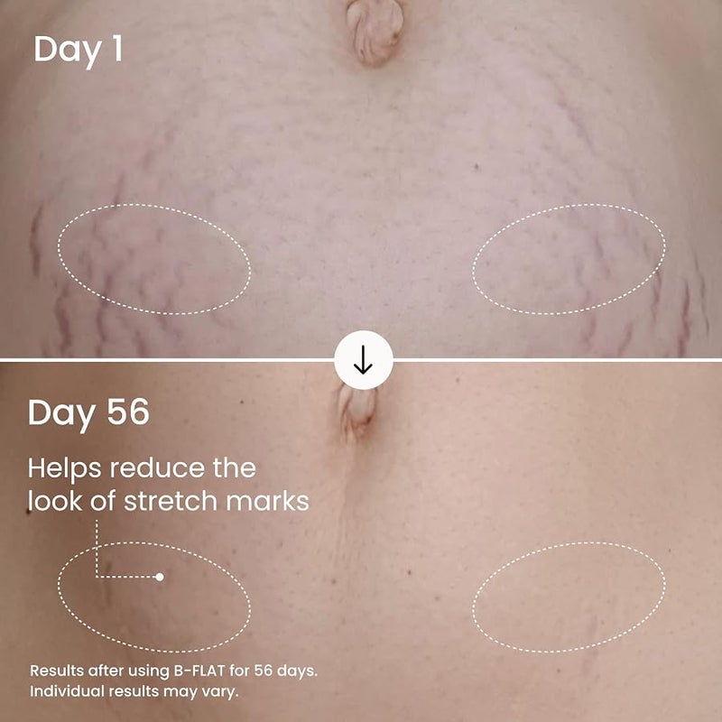 Maelys B-Flat Cellulite Stretch Marks Firming Cream | Belly Skin Treatment | Anti-Cellulite Stomach Lotion with Arabica Coffee & Hyaluronic Acid. - Image 4