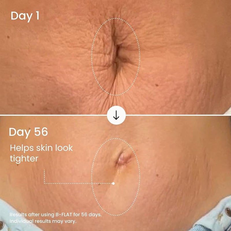 Maelys B-Flat Cellulite Stretch Marks Firming Cream | Belly Skin Treatment | Anti-Cellulite Stomach Lotion with Arabica Coffee & Hyaluronic Acid. - Image 5
