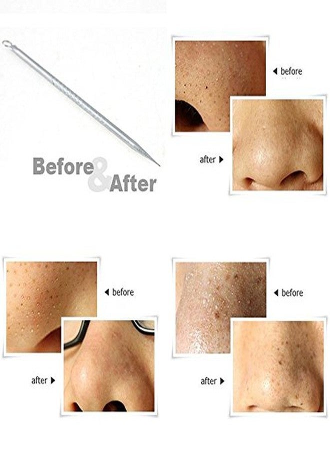 Out Of Box Stainless Steel Slant-Pointed Tip Tweezer Plucker Hair Removal Tool (2in1) with Blackhead Remover Needle (Pack of 3) - Image 4