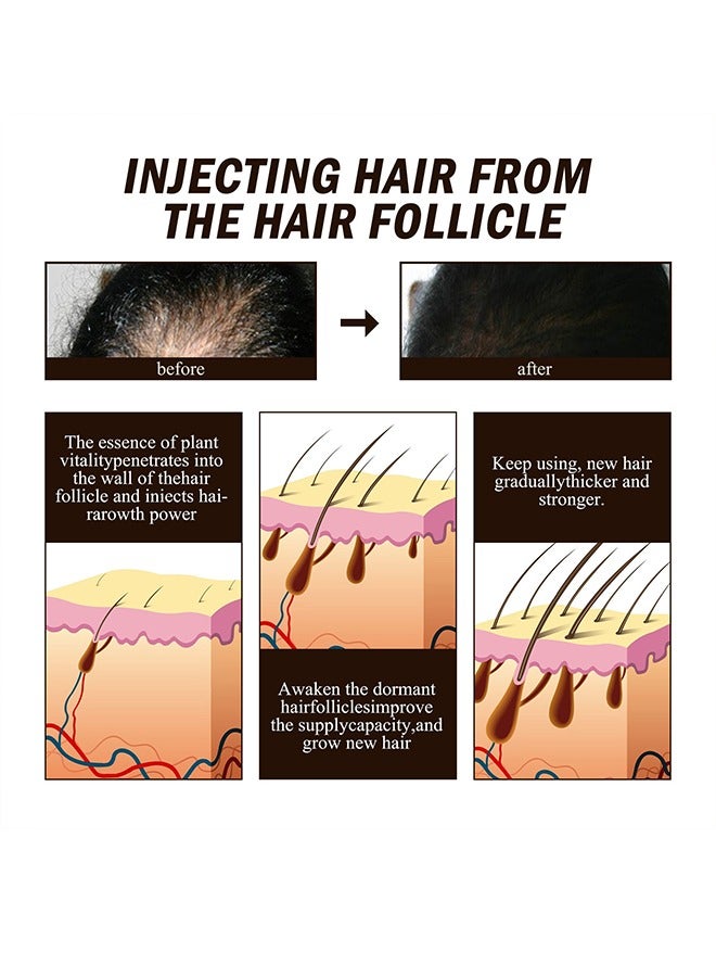 OUHOE Hair Regrowth，Ginger Hair Thickening Spray Anti-Hair Loss Firming Nourishing Strong and Thick Hair, Treatment Hair Growth Essence, Dense Hair Regeneration Spray, Suitable for Men and Women(20ml/0.7fl.oz) - Image 5