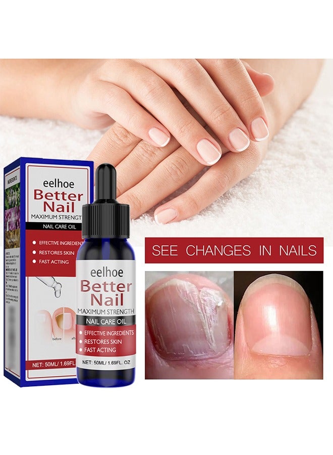 EELHOE Nail Care Oil，Better Nail Maximum Strength ，Nail Repair Essnce Liquid, Fingernail and Toenail Repair, Fix & Renew Damaged, Broken, Cracked & Discolored Nails, Reduce Nail Thickening, Strengthen Nails for Beautiful Nail 50ML - Image 1