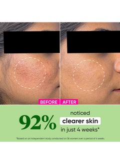 Dot & Key Dot & Key Niacinamide + CICA (Centella) Oil Free Moisturizer for Acne Prone Skin | Oil Free & Lightweight | Fades Dark Spots & Blemishes, Soothes Redness | Acne Cream | For Oily Acne Prone & Sensitive Skin | 50gm  - Image 3