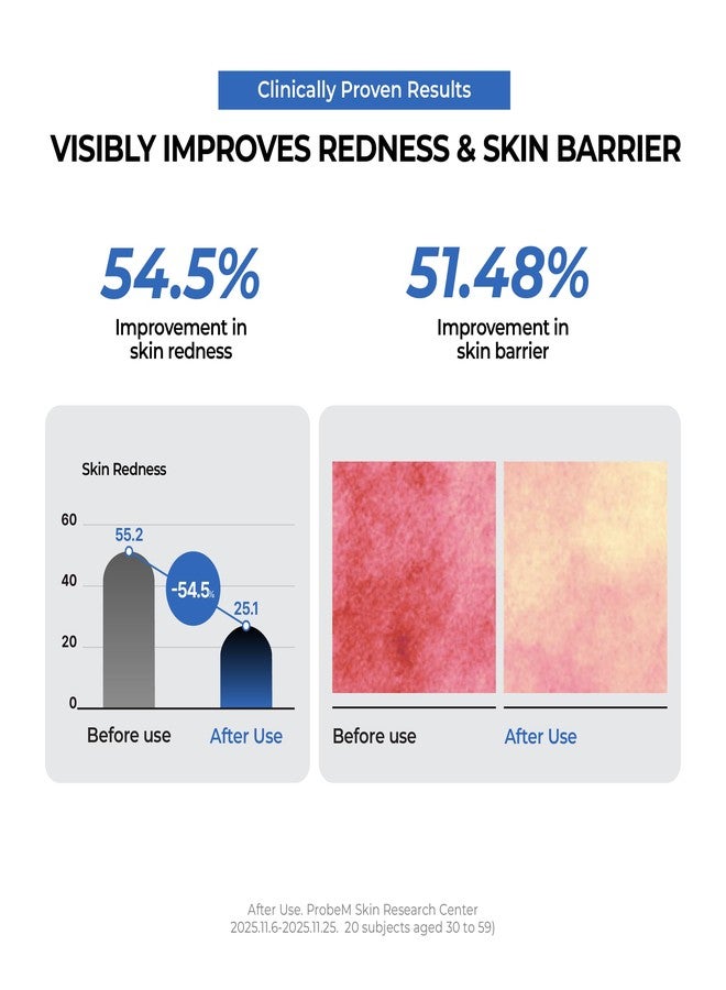 JUMISO Urea 9.9 Intensive Multi Balm - Korean Moisturizer for Extremely Dry Rough Cracked Skin - Deep Hydrating, Barrier Repair with Ceramide NP, Panthenol, TECA Liposome, Fast Absorbing, 1.69 oz - Image 5