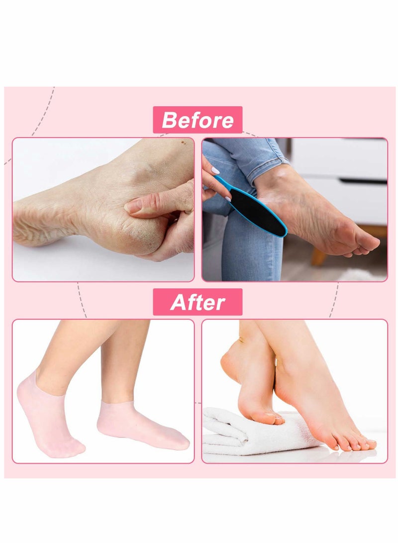 SYOSI 2 Pairs Silicone Gel Moisturizing High Elastic Moisturizing Socks, Soft Silicone Sock Breathable Foot Anti Cracks Protector Comfortable Moisturizing Non Slip Socks for Dry Hard Cracked Skin  - Image 3