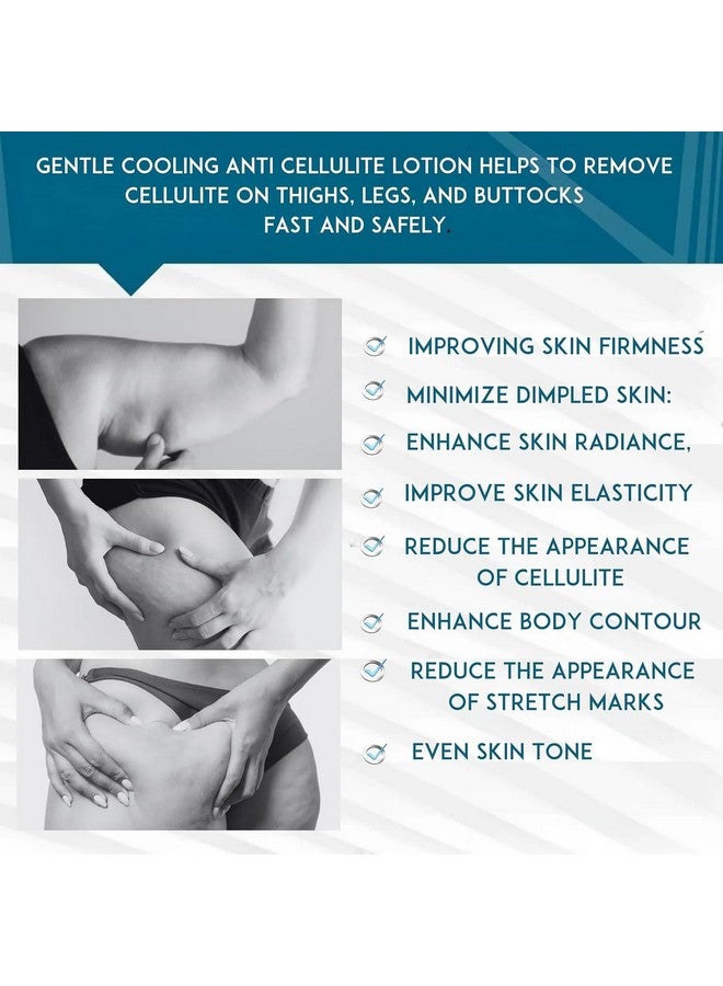 Anacis Cellulite Cream Treatment Reaffirming Complex Gel Diminishes The Appearance Of Uneven Skin Tone And Rejuvenate 5.07 Oz - Image 2