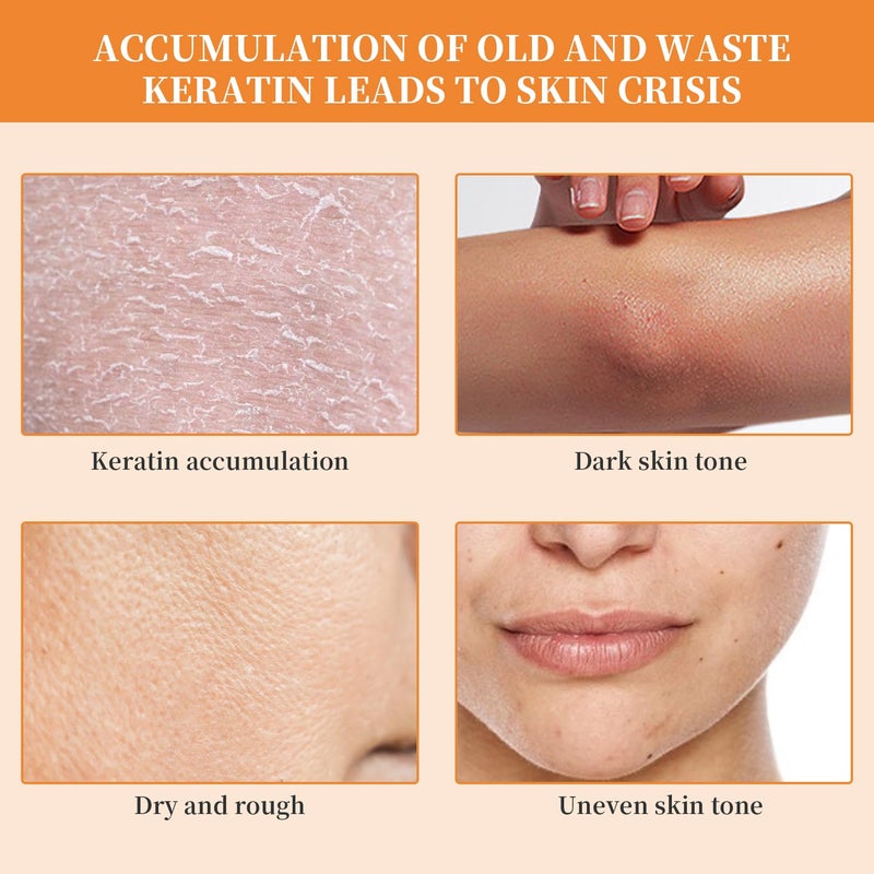 TPTAL Orange Exfoliating Gel Scrub Face Body Skin,Natural Orange Peeling Gel Face Scrub,Deep Cleansing Moisturizing Facial Exfoliator 50g (2PCS) - Image 2