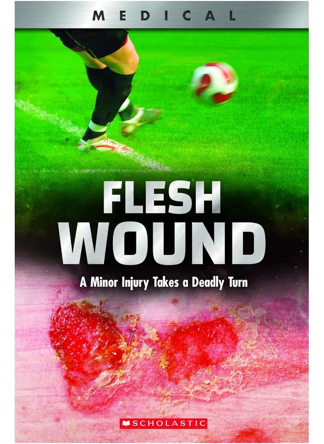 Flesh Wound (Xbooks): A Minor Injury Takes a Deadly Turn 