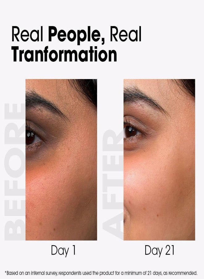 TAC - The Ayurveda Co. واقي شمس غير مرئي TAC SPF 50 PA+++ مع الإلادي و النيم | مضاد للمعان، يمنع حب الشباب و يتحكم في الزيوت | بدون أثر أبيض | غير كوميدوغينيك | خفيف و غير دهني | للبشرة الدهنية و المعرضة لحب الشباب | 50 جرام - Image 5