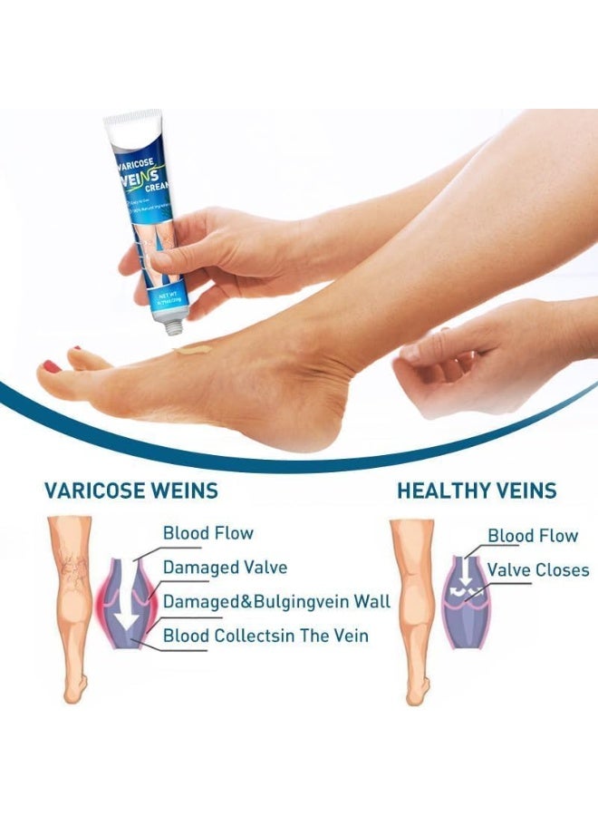 Sumifun Varicose Veins Cream by Vein Smoothing, Spider Veins Repair Cream for Legs and Improve Blood Circulation - Image 4