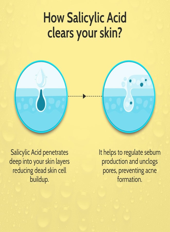 Chemist At Play 2% Salicylic Acid Face Serum for Acne | Serum for Acne and Dark Spots | Improves Skin Texture | Controls Excess Oil | Lightweight, Non-Comedogenic | For Men & Women | 10 ml - Image 5