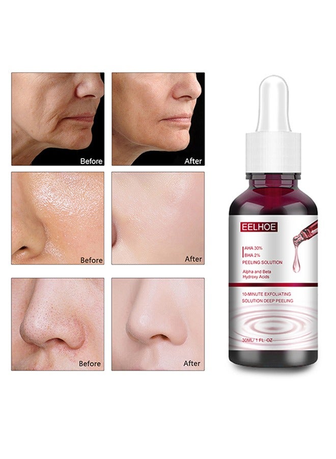 إيلهو محلول تقشير - AHA30٪ + BHA 2٪ جوهر حمض الساليسيليك ، إصلاح ترطيب النغمة ، تقشير قوي و Deepcleamsingofpores ، 30 مل - Image 1