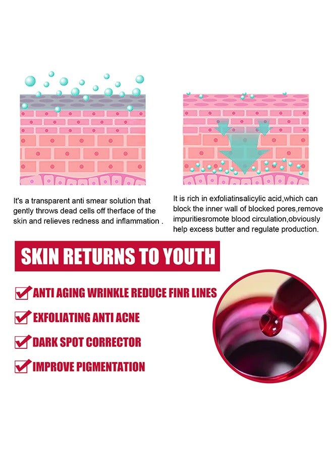 إيلهو محلول تقشير - AHA30٪ + BHA 2٪ جوهر حمض الساليسيليك ، إصلاح ترطيب النغمة ، تقشير قوي و Deepcleamsingofpores ، 30 مل - Image 5