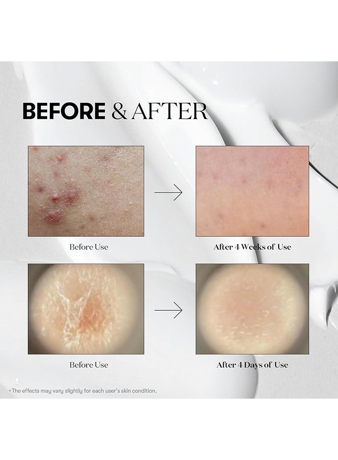 VT Reedle Shot 100 Essence, Daily Face Essence for Soft Skin, Centella Complex, Hyaluronic Acid, Green Propolis Extract for All Skin Types 50ml - Image 5