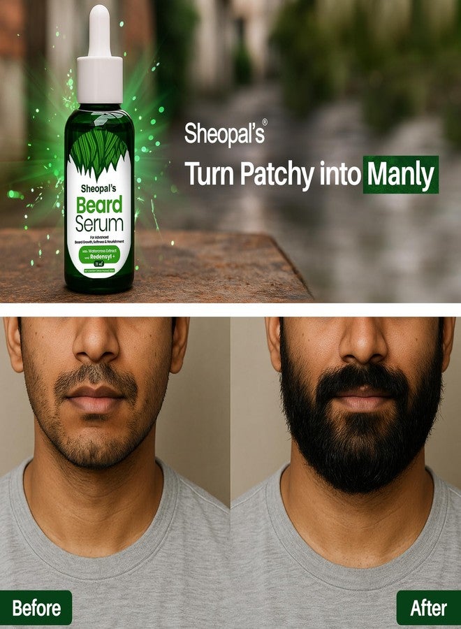 Sheopal's Sheopals Beard Growth Serum for Men with 3X Redensyl - Fast Beard Growth Serum for Thicker, Fuller & Patchy Beard - Non-Sticky Formula - 35ml - Image 2