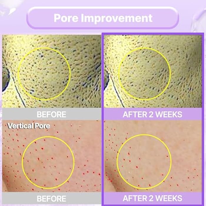 BIOHEAL BOH كريم إعادة تشكيل الكولاجين BIOHEAL BOH Probioderm™ 1.69 أونصة سائلة (50 مل) | كريم شد المسام مع 150,000 كبسولة كولاجين لثبات ونعومة البشرة | مرطب خفيف لبشرة خالية من العيوب - Image 5