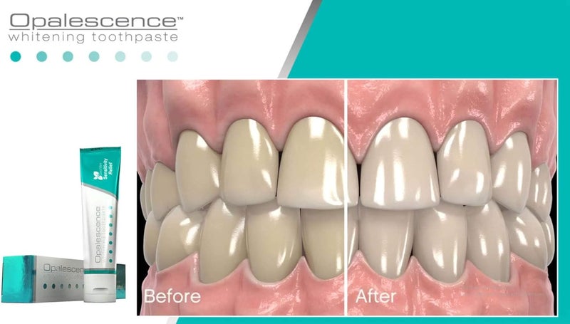 Opalescence معجون أسنان أوباليسنس لتبييض الأسنان وتخفيف الحساسية 100 مل - Image 2