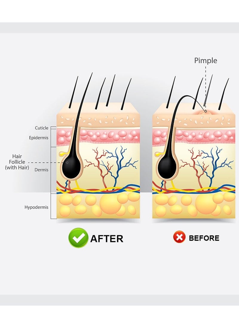 Sumifun 2-PACKS Hair Follicle Cream, Relieves Itchy and Red Skin, Skin Care Cream 20g*2 - Image 4