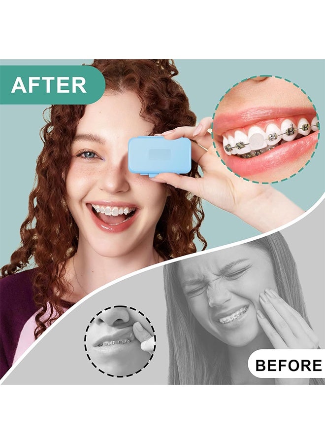 ٦ علب من شمع تقويم الأسنان، شمع تقويم الأسنان برائحة الفواكه، للعناية بالفم، تقويم الأسنان السيليكوني، حماية اللثة، الأسنان (٦ روائح) - Image 5