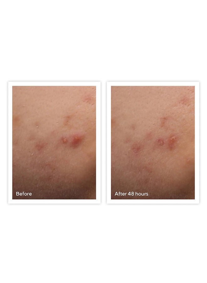 Murad علاج بقع العيوب السريع - يقلل بسرعة من حجم واحمرار العيوب، يعمل طوال الليل للحصول على نتائج سريعة (15 مل) - Image 5