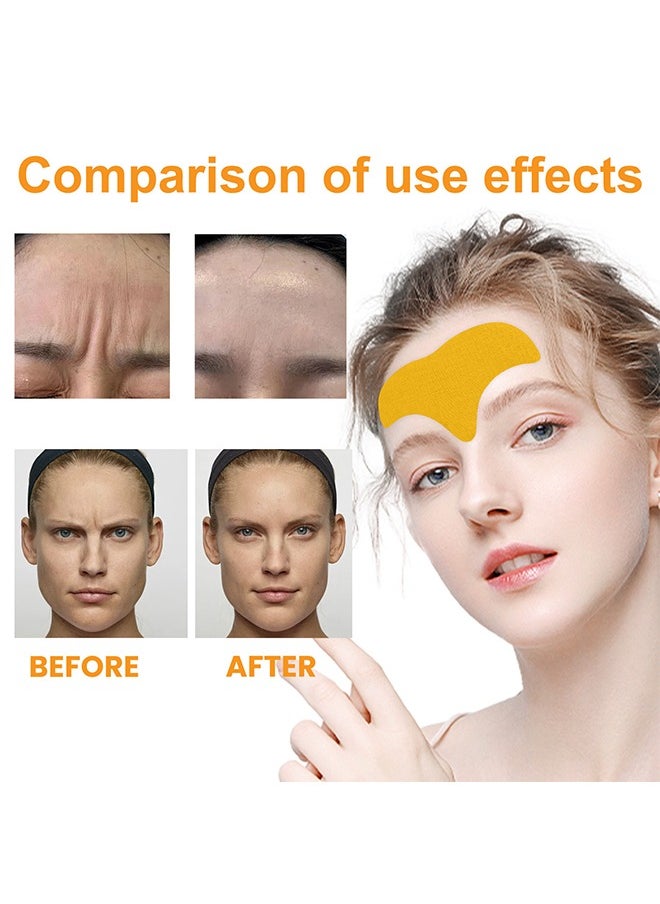 EELHOE - Forehead Wrinkle Patche, Minimize the Appearance Of Fine Lines And Wrinkles, Smooth Out Skin Texture On Forehead, Improve The Overall Appearance of Skin . Fades Smooth Wrinkles Lifts And Tightens Facial Skin Anti-Wrinkle Patch 10 Pieces - Image 1
