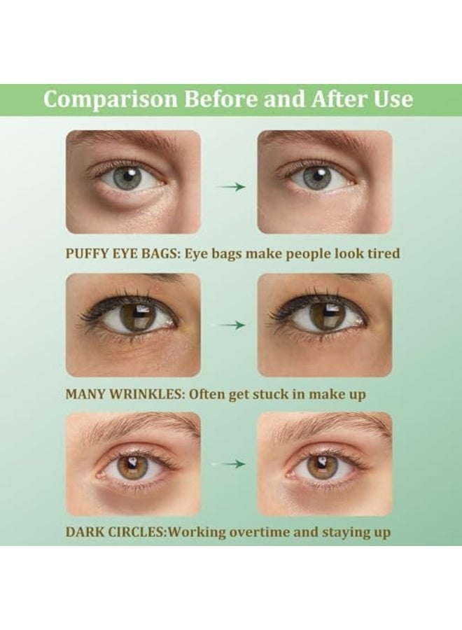 Zozu Under Eye Patches, Collagen Under Eye Mask, Dark Circles Under Eye Treatment, Puffy Eyes Bags Under Eyes Removal, Anti-Aging, Reduce Wrinkle, Skincare, Hydrating - 30 Pairs (Avocado) - Image 3