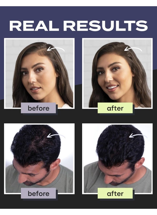 Toppik Hair Building Fibers with Premium Keratin Fibers Conceals Hair Thinning and Hair Loss for Fuller Looking Hair that Gives Completely Natural Look For Men and Women, Medium Brown, 12 grams - Image 2