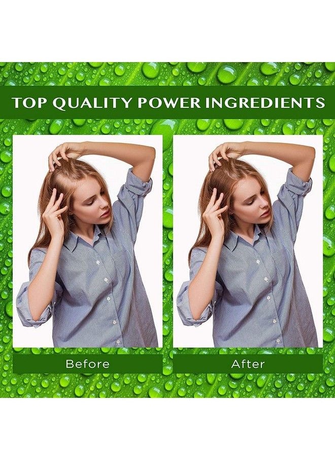 EssyNaturals Advanced - Hair Growth Serum Hair Growth Oil With Biotin & Castor Oil Hair Growth For Women Hair Loss Treatments Rosemary Oil For Hair Growth Hair Growth Products For Thicker Longer Fuller Healthier Hair - Image 1