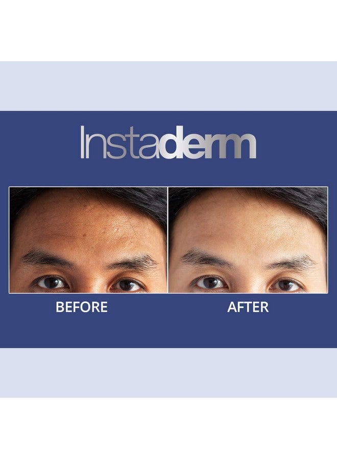 Instaderm nti-Aging Exfoliating Peel Pads -Chemical Peel Pads with Glycolic, Lactic, and Salicylic Acid. Smooth’s Fine Lines, Wrinkles, Dark Spots & Skin Roughness to Enhance the Skins Texture & Tone - Image 5
