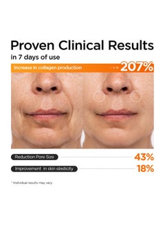 P.CALM P.CALM Retinolagen Ampoule 30ml | Pore Tightening Korean Glass Skin Serum for Retinol Bigginer with Micro Dosing Retinal, Vegan Hydrolyzed Collagen, Bakuchiol, PHA | Vegan Korean Skincare  - Image 3